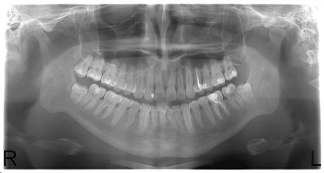 ortodontiya.jpg